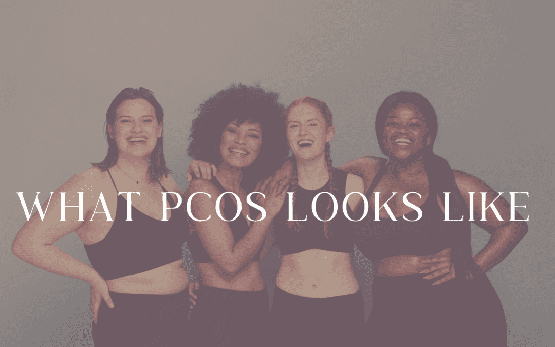 types of pcos